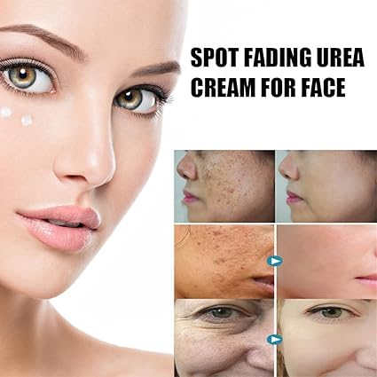 61cT908n+cL._SX425_ Spot Fading Urea Cream, Milkydeck Spot Fading - Image 3