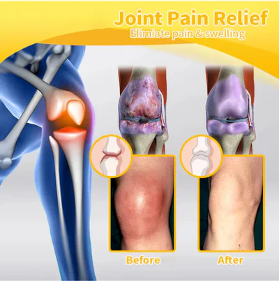 dau-3-20240926130608-5nlfw-1-20241113083016-orgq3 PainGuard Joint Gel - OSTEOARTHRITIS ARTHRITIS CREAM - Image 3